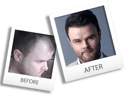 alviarmani-patients-testimonials-before-after