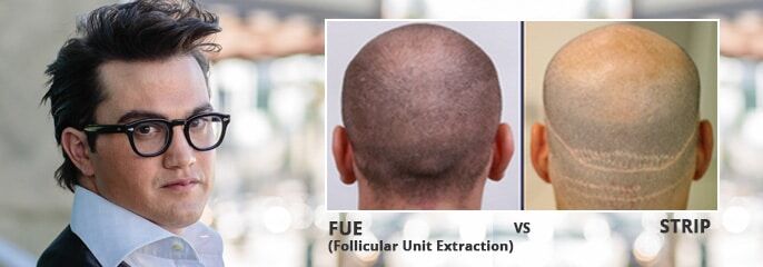 alviarmani-fue-vs-strip