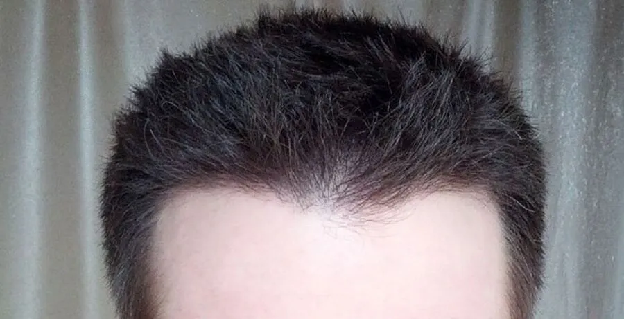 hairline8
