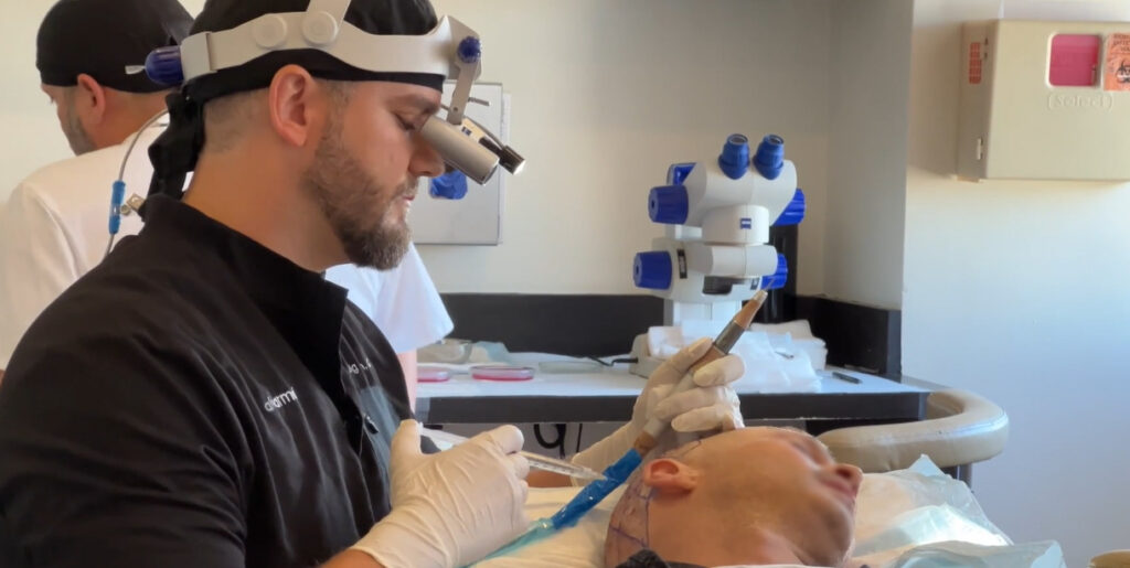 Dr. Barton Performing Injectables of Non Surgical Hair Loss Solutions
