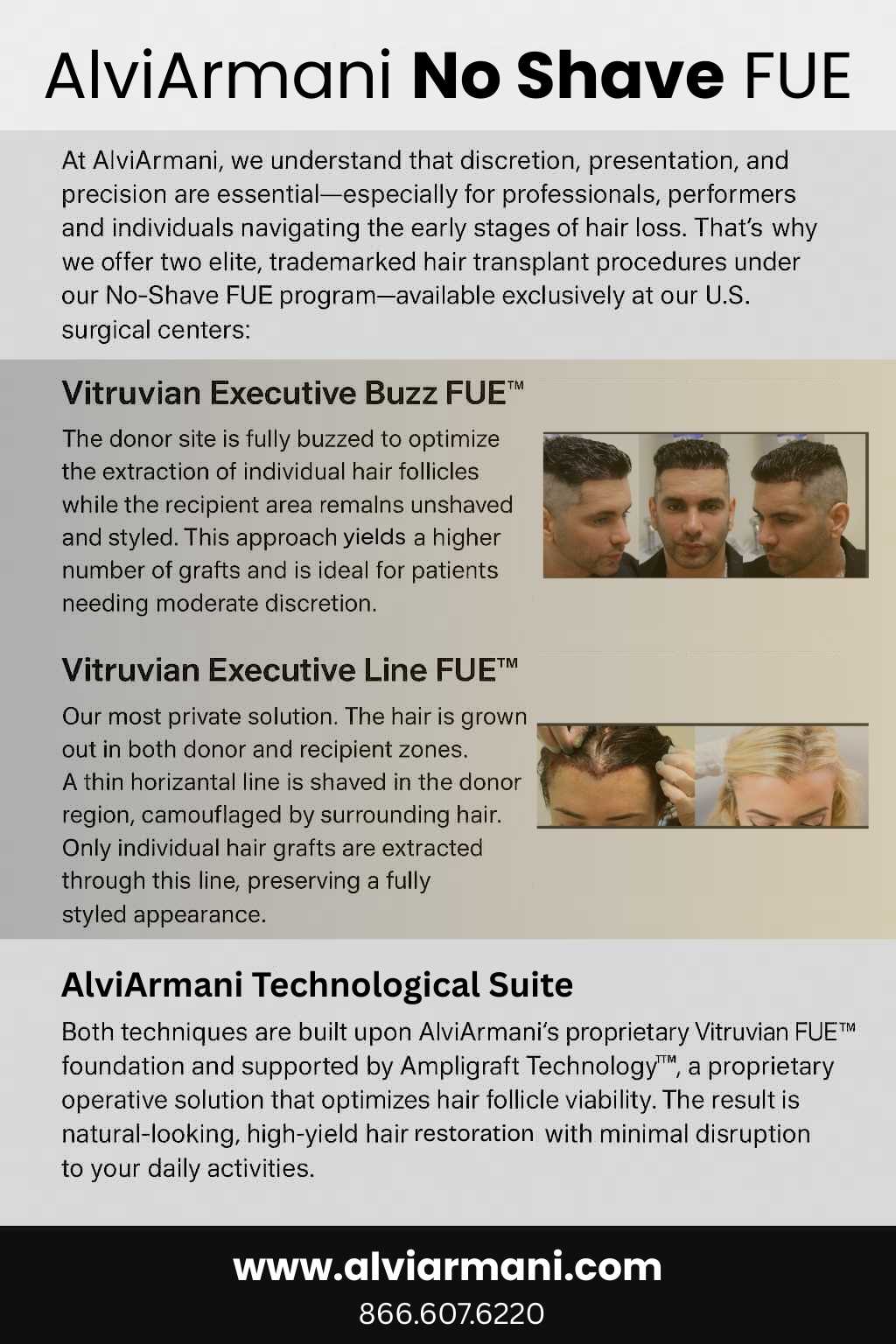 AlviArmani No Shave FUE-3 AlviArmani No Shave FUE Hair Transplant Offerings