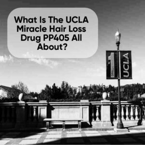 Is PP405 The Answer To Hair Loss?