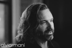Utah Hair Restoration Long Hair Result