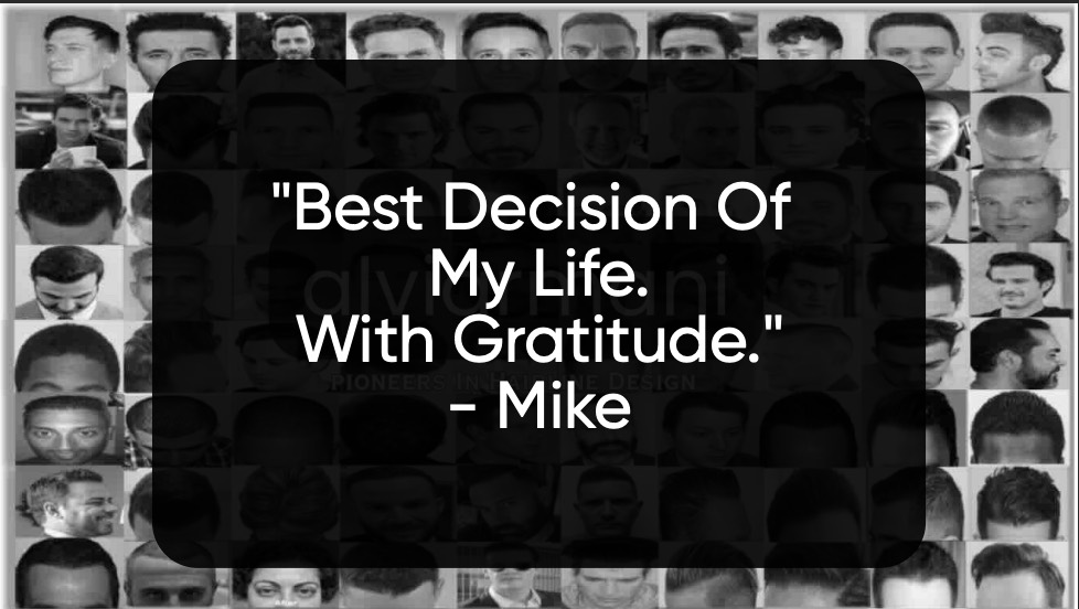 AlviArmani Hair Transplant Reviews. "The Best Decision of My Life. With Gratitude." -Mike