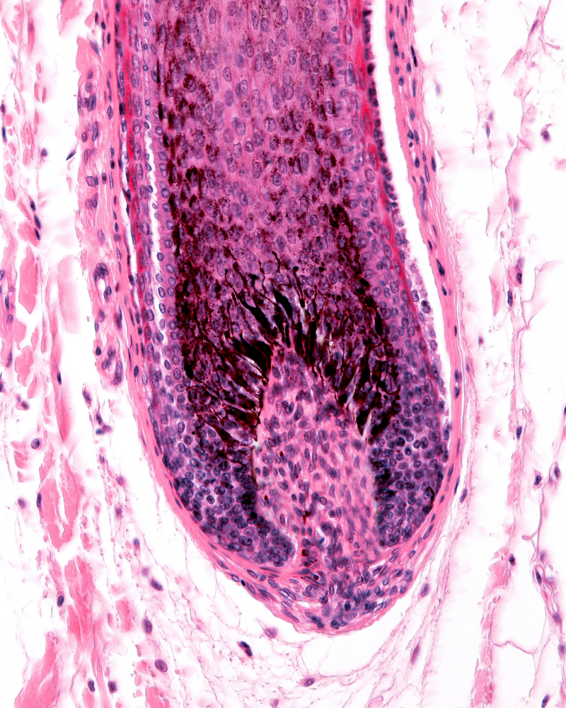 Hair Follicle Root