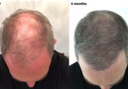 4Months